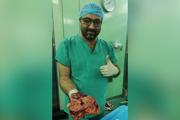 نجاح عملية جراحية نادرة في كركوك 