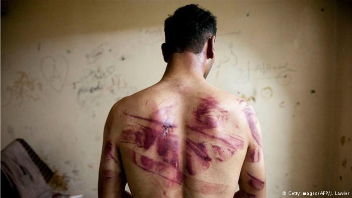 جرائم التعذيب في سوريا