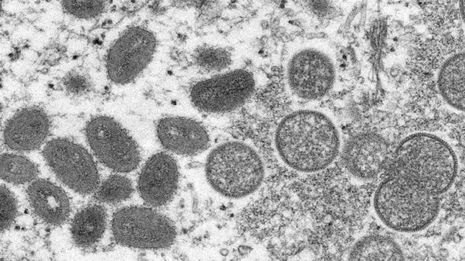 An electron microscope image showing mature, oval-shaped monkeypox virions (left) and spherical immature virions from a 2003 US outbreak. Photograph: AP