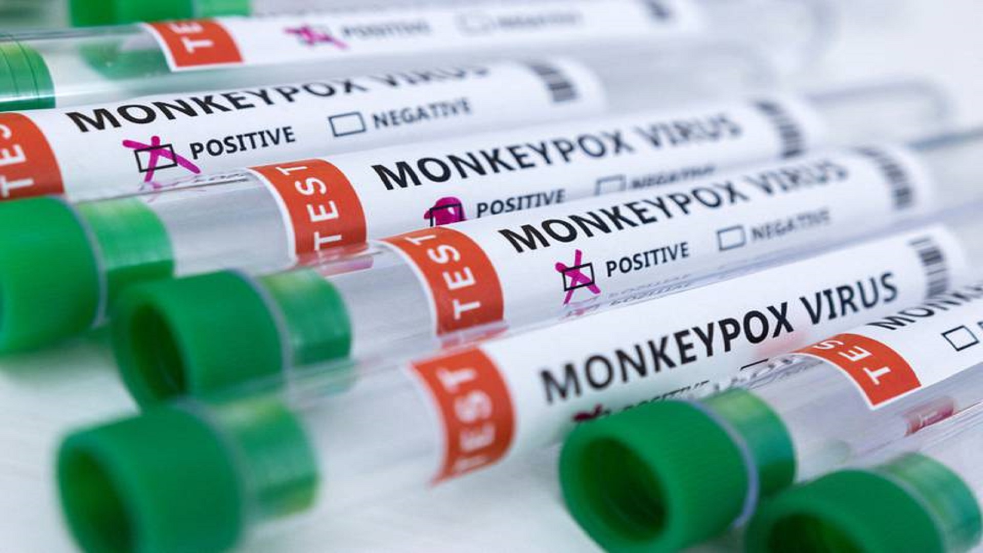 Test tubes labelled "Monkeypox virus positive and negative". Reuters