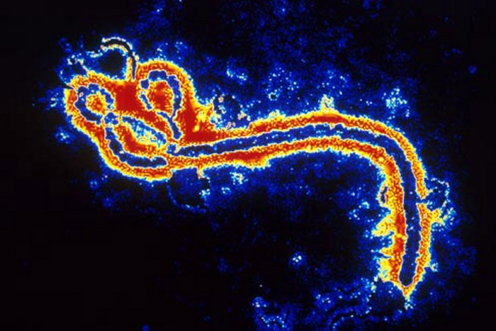 ئیبۆلا، نه‌خۆشییه‌كی كوشنده‌یه‌ كه‌ توشی مرۆڤ و ئاژه‌ڵان ده‌بێت
